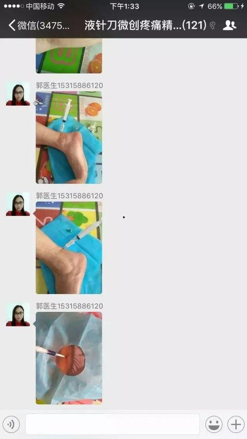 小针刀治疗视频,视频教学深度解读